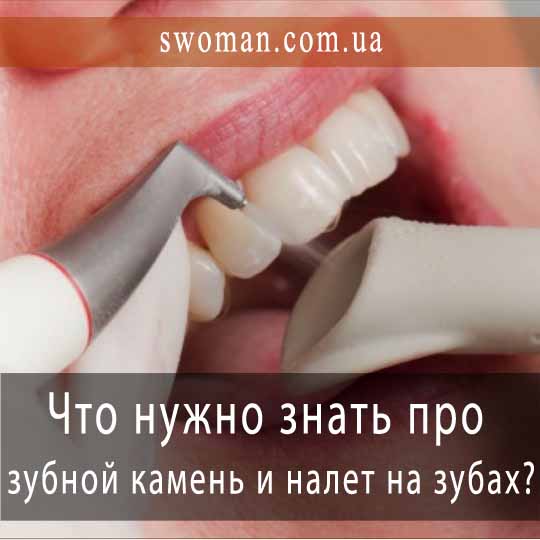 Что нужно знать про зубной камень и налет на зубах?