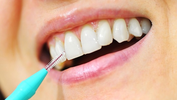 Как правильно чистить зубы зубным ершиком